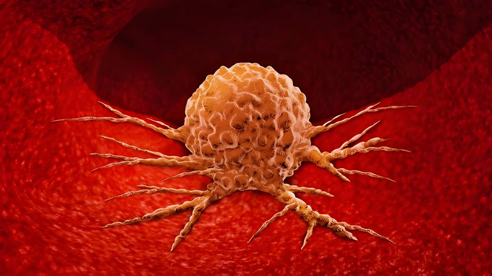 Histrelin Buy | Shaanxi BLOOM Tech Co., Ltd Histrelin Buy | Shaanxi BLOOM Tech Co., Ltd