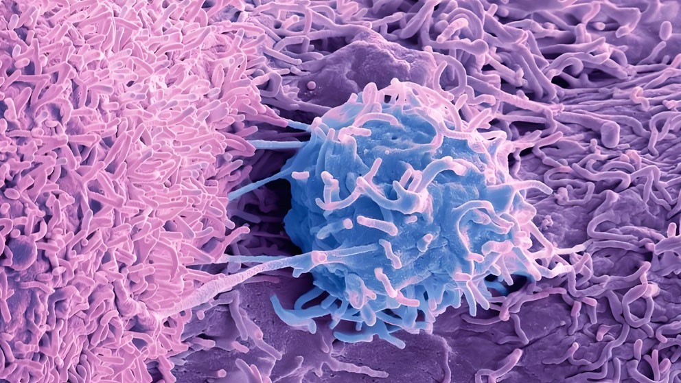 Histrelin Cost | Shaanxi BLOOM Tech Co., Ltd Histrelin Cost | Shaanxi BLOOM Tech Co., Ltd